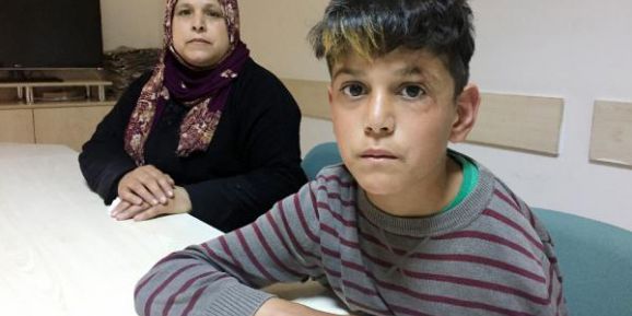 Suriye'deki İç Savaştan Kaçtı, Kazada Kolunu Kaybetti