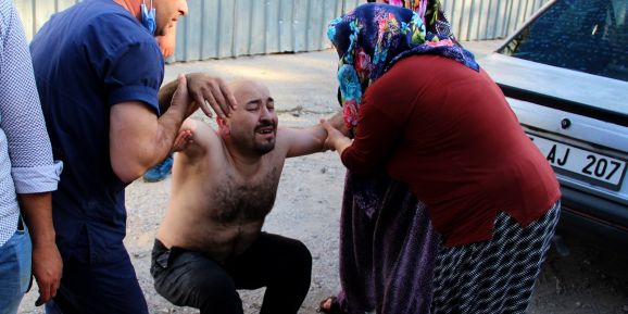 Ekmek teknesini kurtarmak için alevlerin arasında dalan iş yeri sahibinin sırtı yandı