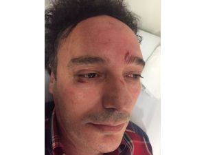 Ümraniye’de doktora saldırı