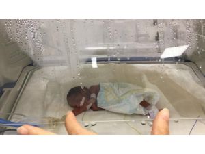 Üç Düşükten Sonra ’Yaşamaz’ Denilen 510 Gramlık Bebekten İyi Haber