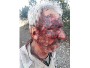 Engelli Vatandaşı Öldüresiye Dövüp Çukura Attı