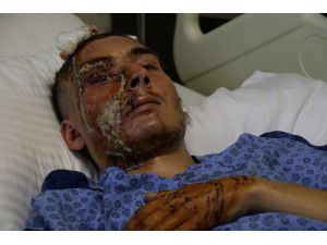 Bu Halde Hastaneden Taburcu Edildi, Ailesi Gözyaşına Boğuldu