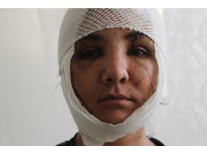 Kocası Yüzünü Bıçakla Paramparça Etti, Ölümden Kıl Payı Kurtuldu