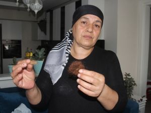 Şiddetin Kanıtı Kızının Saçlarını Gösterip Ağladı