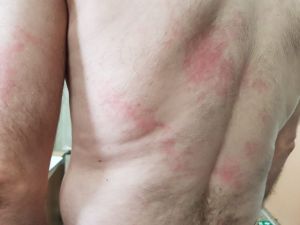Engelli Öğretmen Sıcak Çay Fırlatan Okul Müdüründen Şikayetçi Oldu