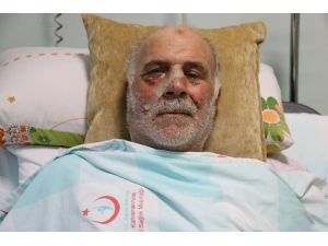 Demir Keserken Yüzünü Parçaladı