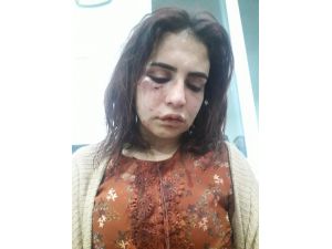 Eski sevgilisi tarafından darp edilen genç kızın “Ölmek istemiyorum” paylaşımı