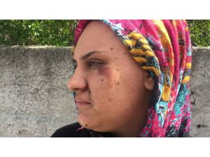 Kapkaççının Sürüklediği Kadın Dehşet Anlarını Anlattı