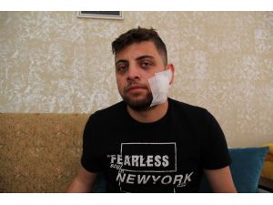 Kadına tokat attı diye uyardı, çatalla yüzünen yaralanıp hastanelik oldu