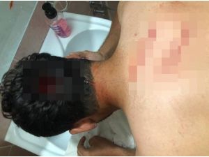 Antalya’da turizm işletmecilerinin ’kısıtlamada müşteri alıyor’ kavgası önce hastanede ardından karakolda bitti