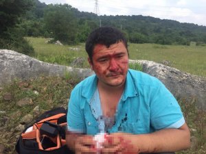 İ̇ha Muhabirine Yapılan Çirkin Saldırıya Bir Kınama Daha