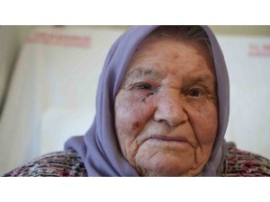 Dört Mevsim Gözyaşı Yağmuru, Bir Cerrahiyle Güneşle Buluştu