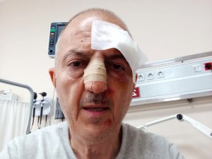 Evden tahliyesi sırasında darp edildi.