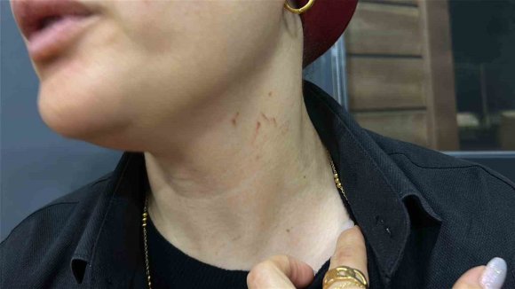 DÜĞÜNDE HALAY BAŞI OLMAK İSTEYEREK KADIN SOLİSTE SALDIRAN ALKOLLÜ ŞAHIS KORKU DOLU ANLAR YAŞATTI