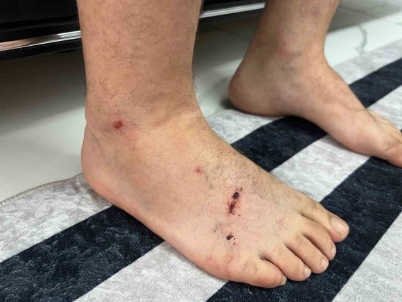 KÖPEK DEHŞETİNİN MAĞDURU MOTOKURYE O ANLARI ANLATTI: "KÖPEK KAFASINI ÇIRPABİLSEYDİ ETİMİ KOPARABİLİRDİ"