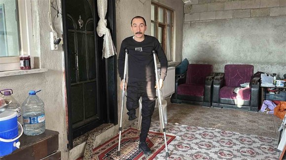 ÇAPA MAKİNESİ KAPTIRDIĞI BACAĞINI KAYBEDEN BABANIN EN BÜYÜK İSTEĞİ KIZIYLA BİRLİKTE GEZEBİLMEK