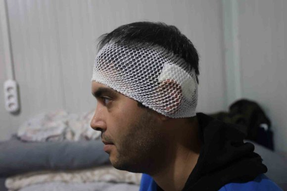 BAYRAM GÜNÜ KONTEYNERİ DELİP GEÇEN YORGUN MERMİNİN KAFASINA İSABET ETMESİYLE KABUSU YAŞADI