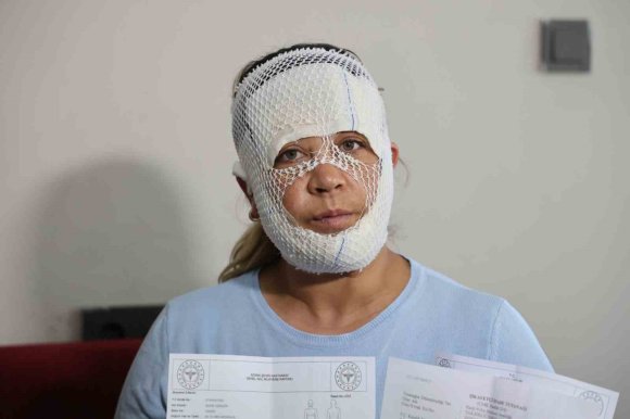 GÜZELLEŞMEK UĞRUNA GİTTİĞİ MERKEZDE YÜZÜ YANDI