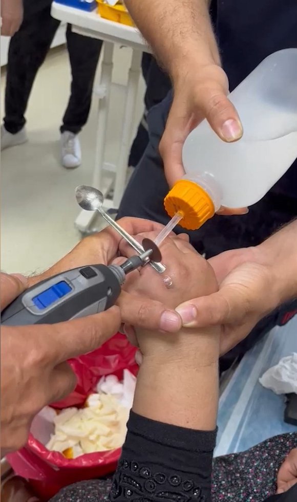 YÜZÜĞÜ PARMAĞINA SIKIŞAN KADININ YARDIMINA İTFAİYE KOŞTU
